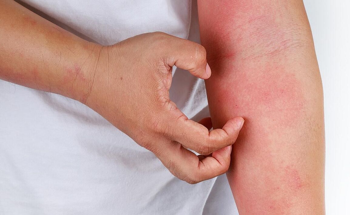 posibles complicacións do uso de refrescos