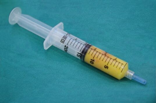 Xiringa con tecido graxo para lipofilling